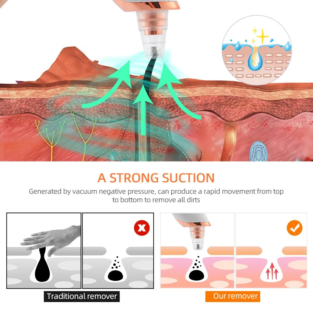 PoreHalo Pro image 5